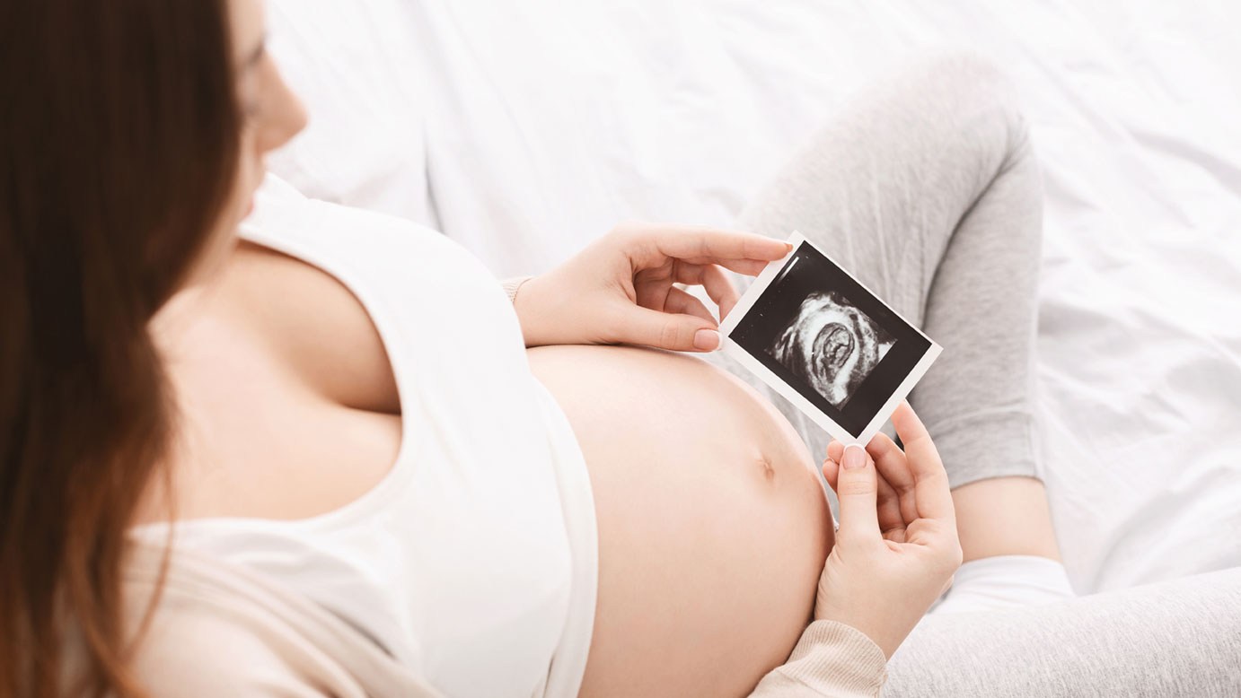 Mutter hält Ultraschall-Bild vor ihren Babybauch: Ein Nasciturus hat bestimmte Rechte in Deutschland.